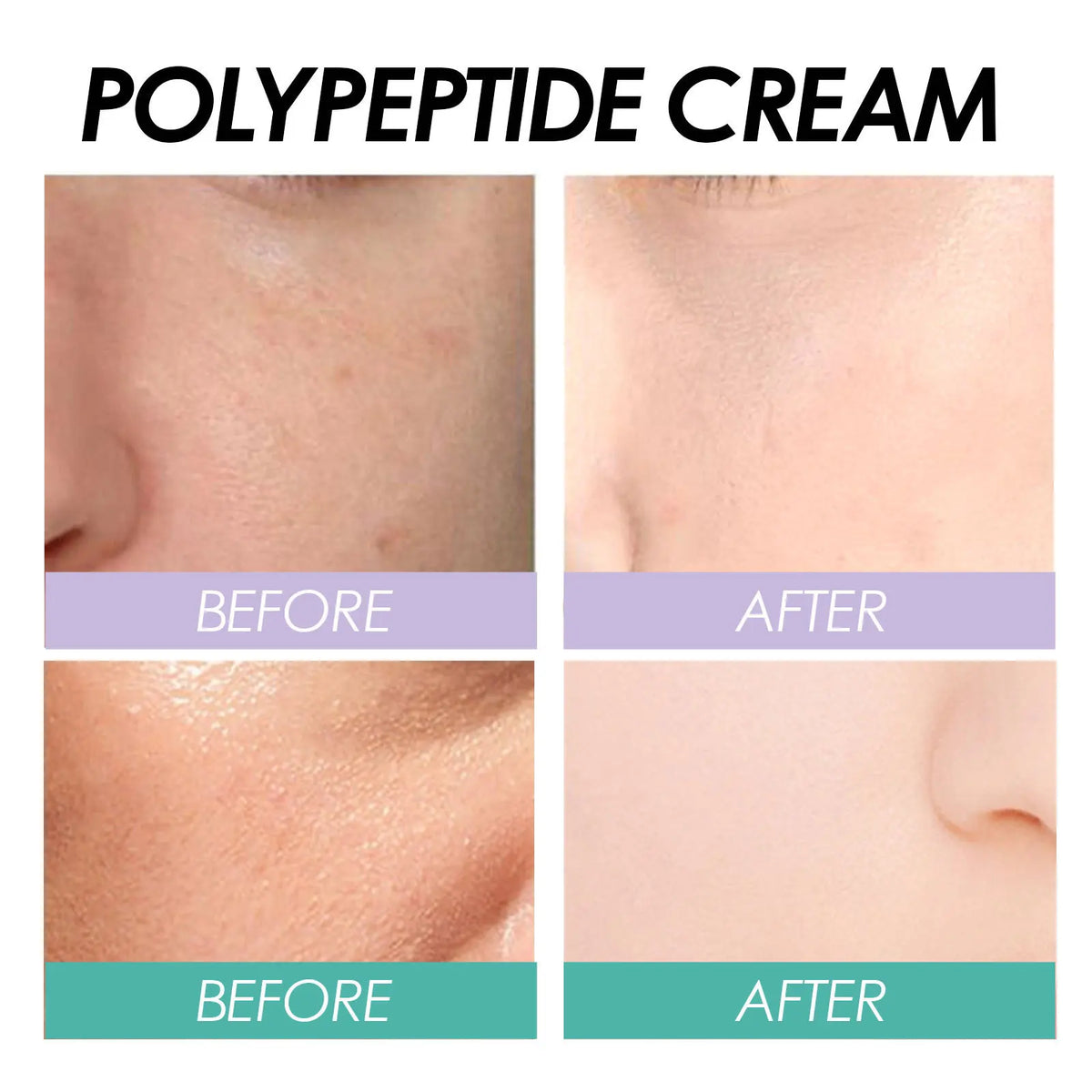 Polypeptide Anti-Aging Moisturizer