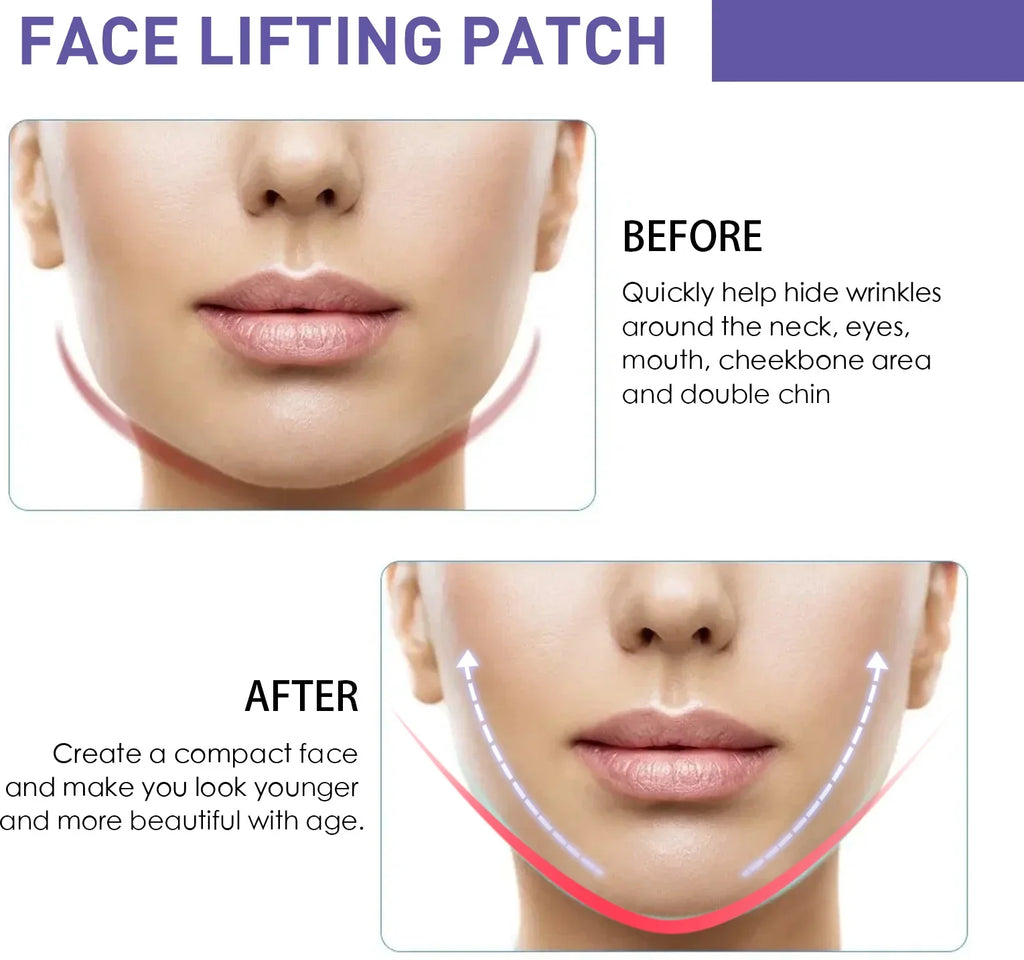 V-Shaped Face Lifting Patches