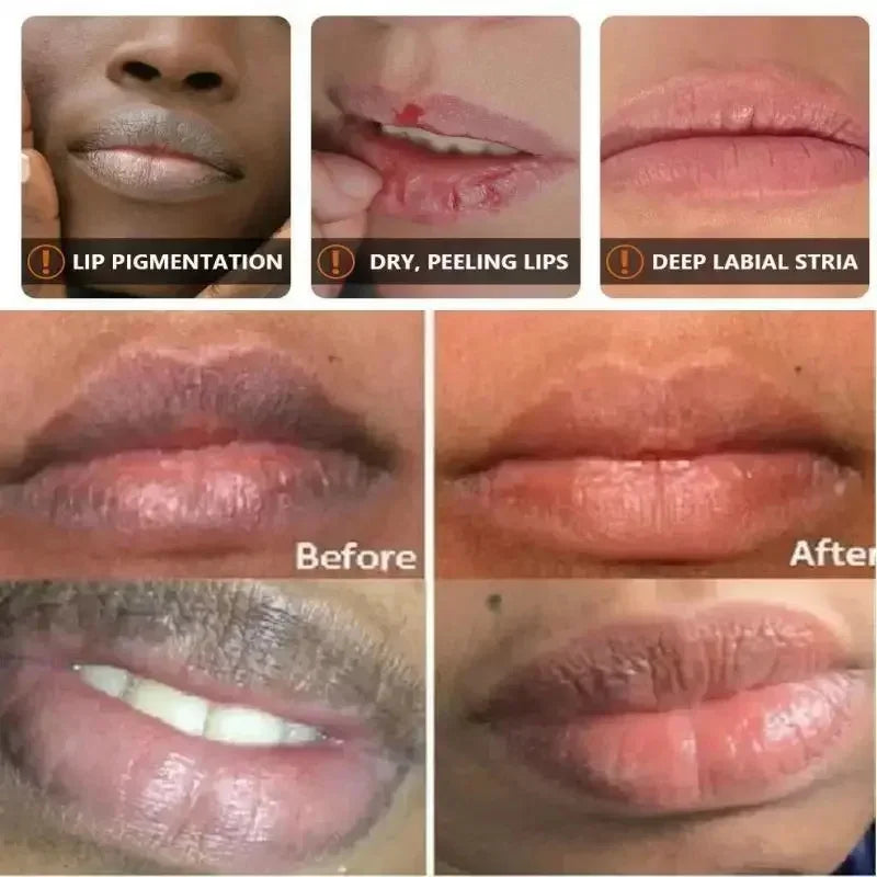 Turmeric Lip Balm